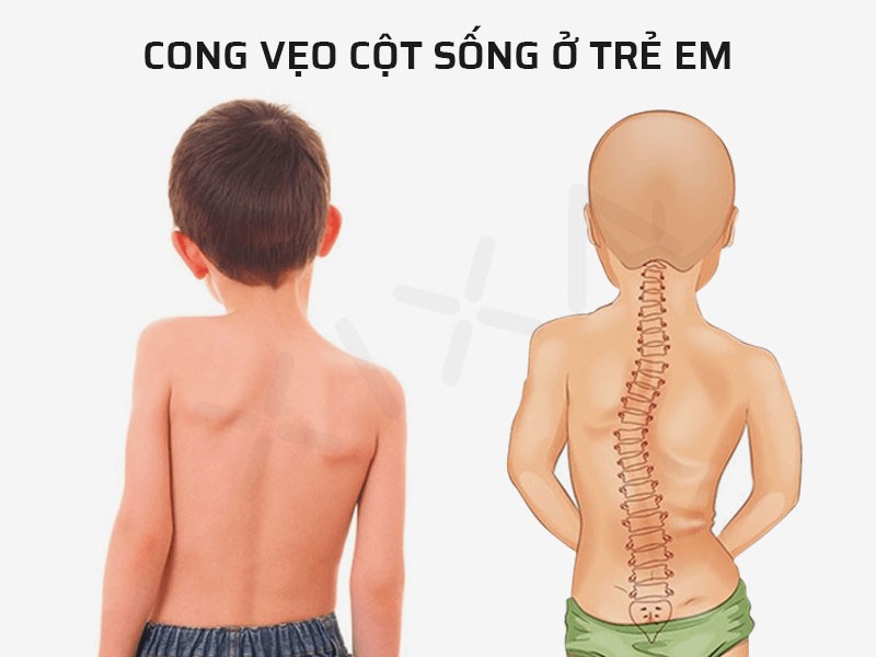 sai tư thế